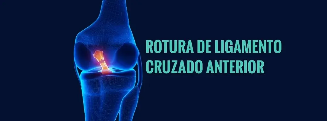 Rotura de ligamento cruzado anterior: todo lo que debes saber