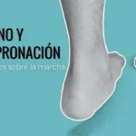 Pie plano y sobrepronación: cómo afecta a la marcha