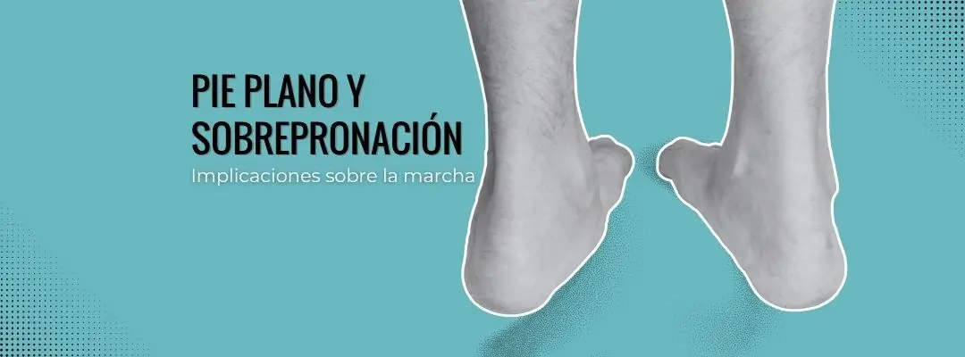 Pie plano y sobrepronación: cómo afecta a la marcha