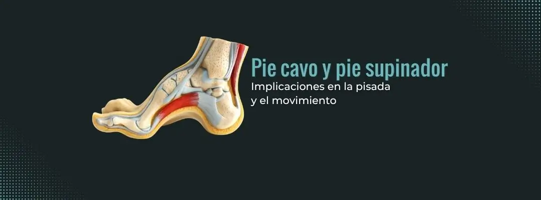 Pie cavo y pie supinador: implicaciones en la pisada y el movimiento