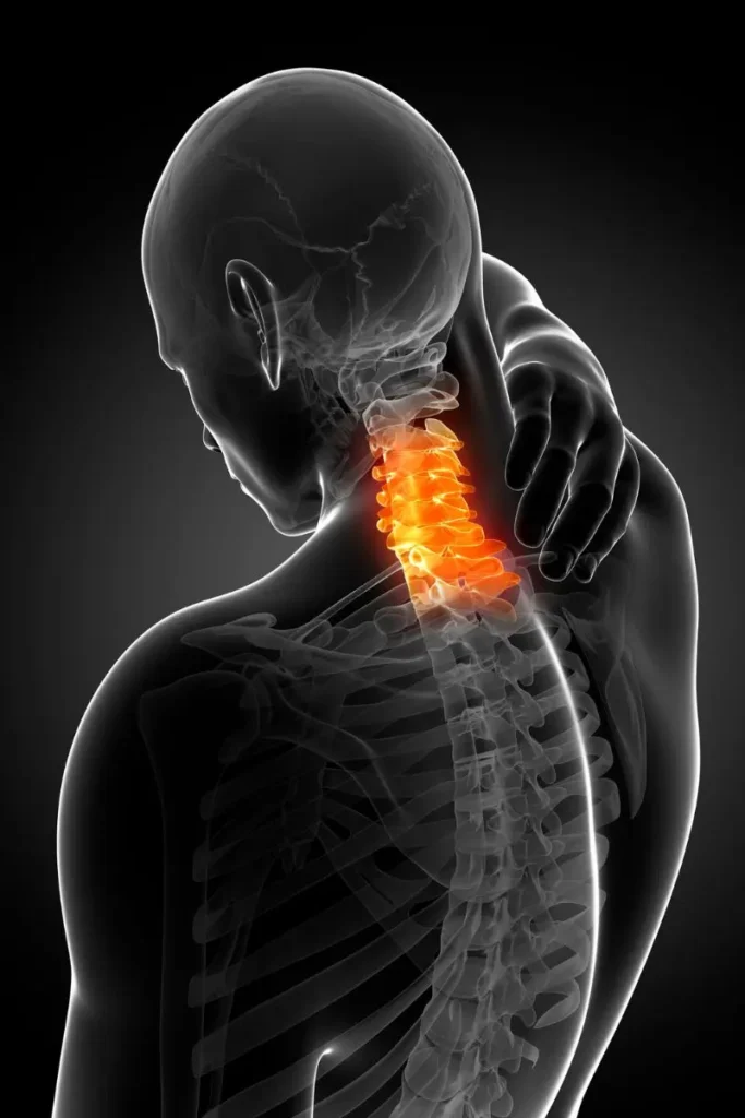 dolor cervical; dolor de cuello
