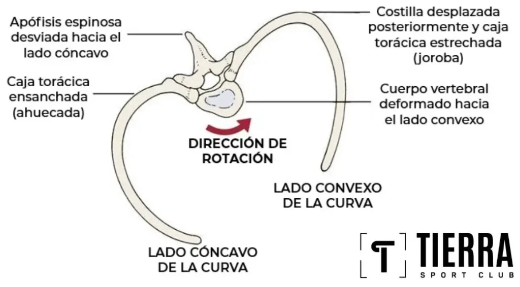 rotación torácica; columna torácica